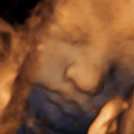 baby 1